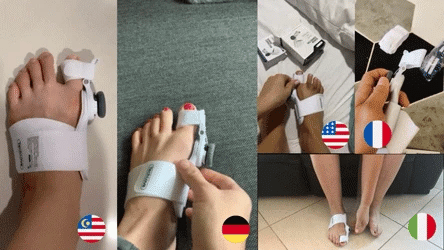 Donrams - Bunion Knob Toe Corrector