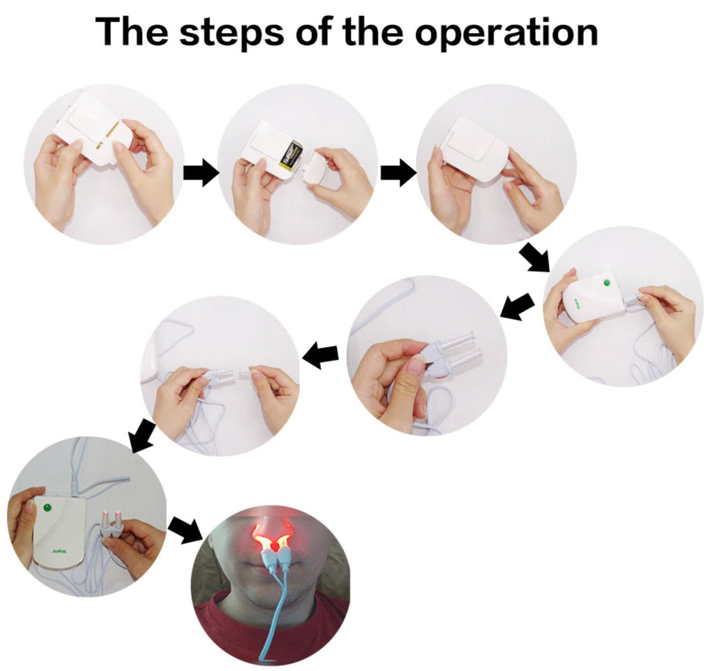 Infrared Rhinitis Therapy Device-CQA9417473196328-564575 CQA9417473196328