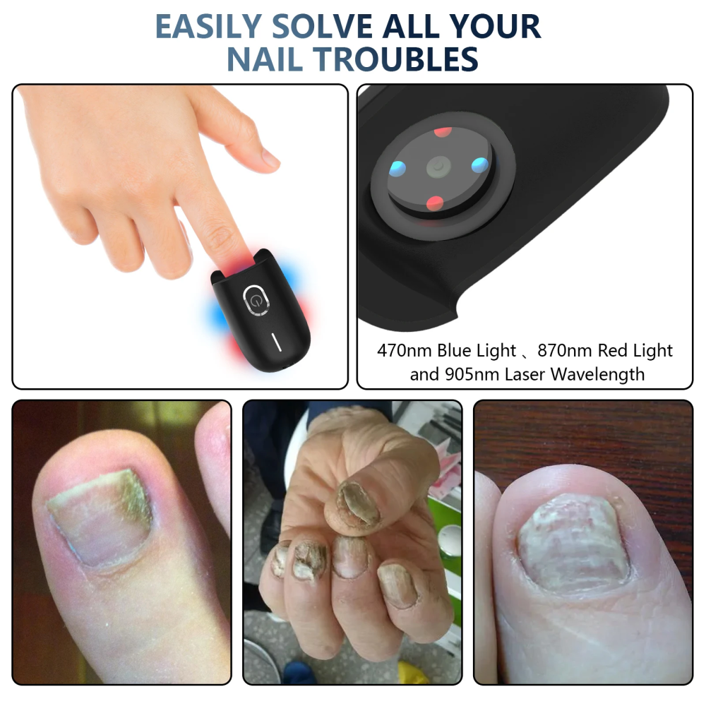 Laser Heal Toenail Fungus Removal Laser-CQA9417459892520-564575 CQA9417459892520