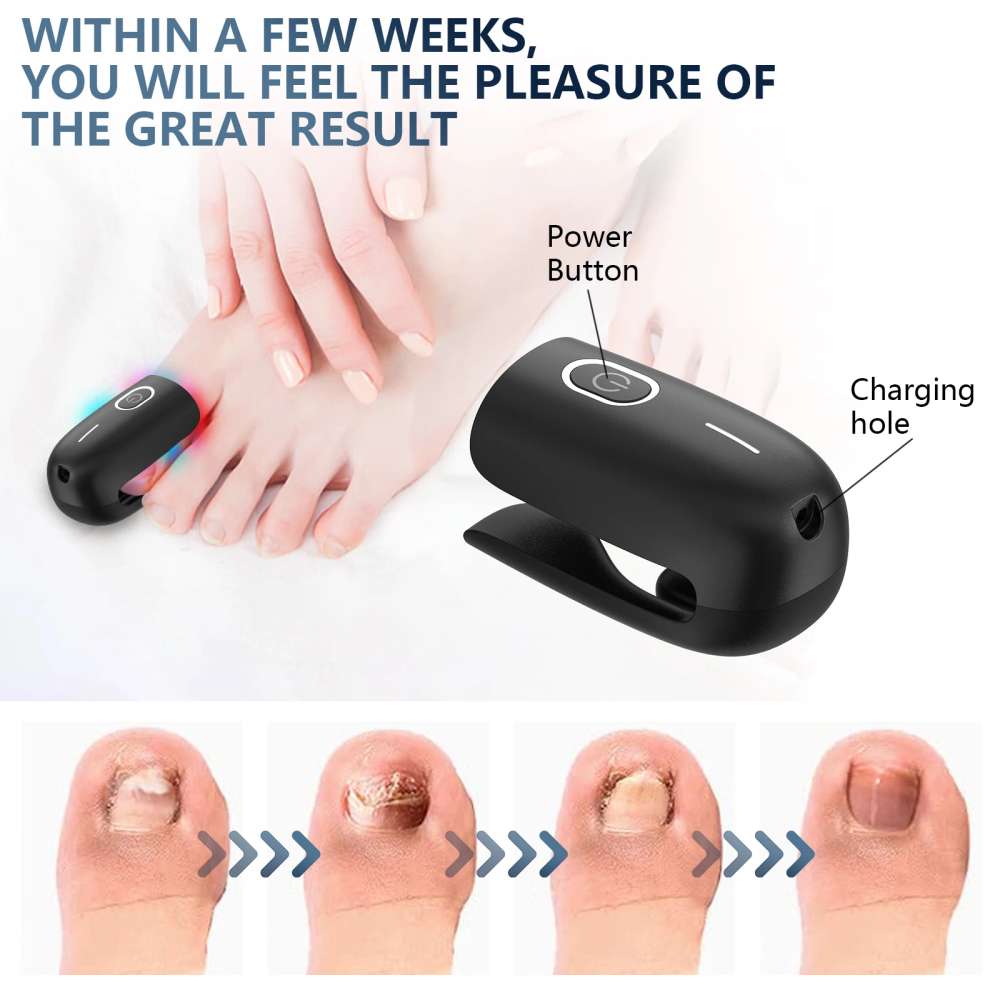 Laser Heal Toenail Fungus Removal Laser-CQA9417459892520-564575 CQA9417459892520