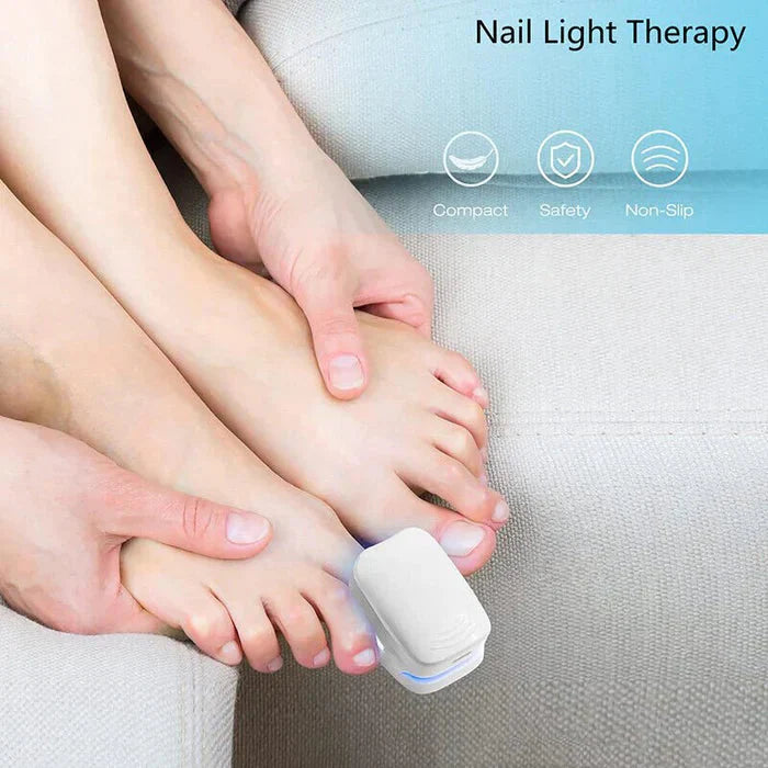 Nail Fungus Cleaning Laser Device - Expert Revolutionary High-Efficiency Light Therapy Device For Toenail Diseases-CQA9417467199784-564575 CQA9417467199784