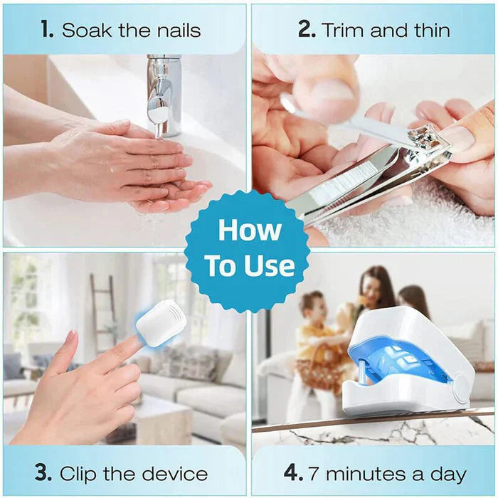 Nail Fungus Cleaning Laser Device - Expert Revolutionary High-Efficiency Light Therapy Device For Toenail Diseases-CQA9417467199784-564575 CQA9417467199784