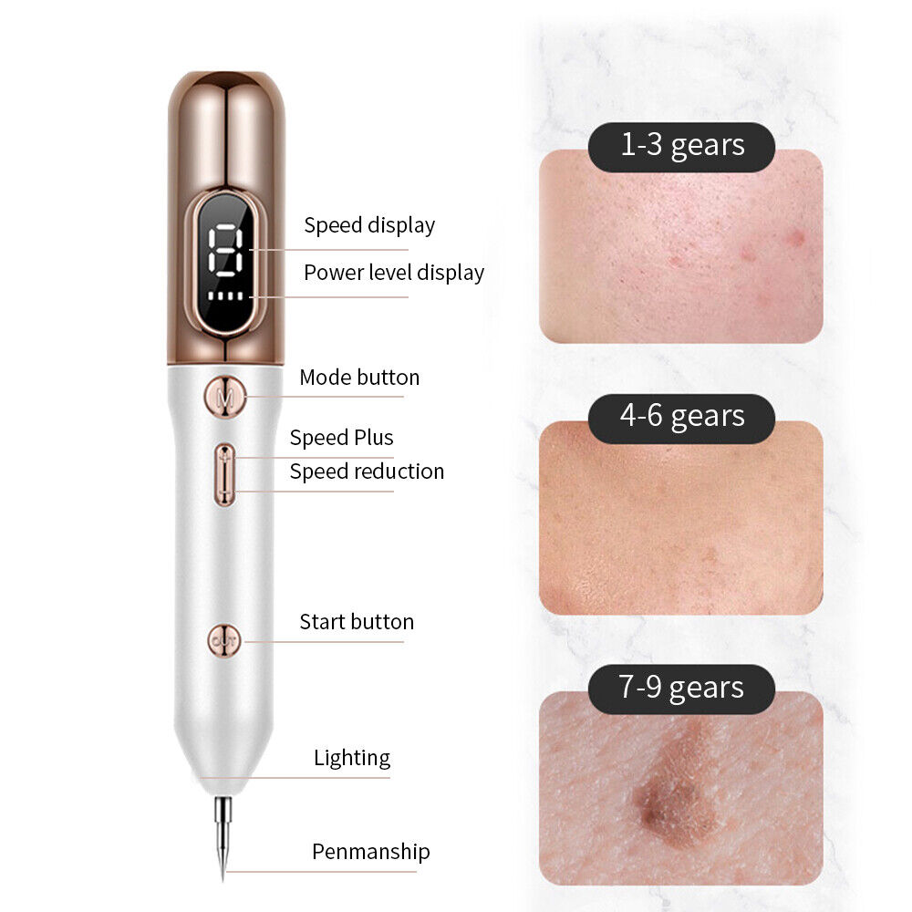 Plasma Pen To Remove Skin Tags, Moles And Warns-564575 